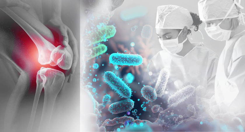 Onkos Surgical Earns Second FDA Clearance for its NanoCept Antibacterial Tech